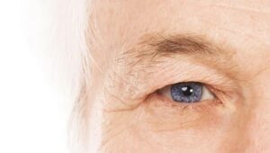 szemhéjplasztika Budapesten